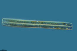 Image of Nitzschia sigmoidea