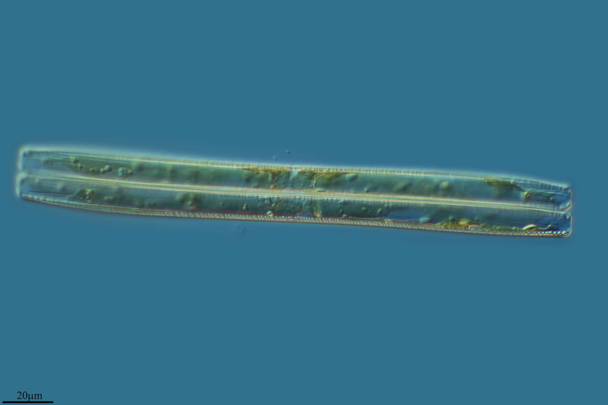 Image of Nitzschia sigmoidea