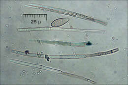 Lachnellula occidentalis (G. G. Hahn & Ayers) Dharne 1965 resmi