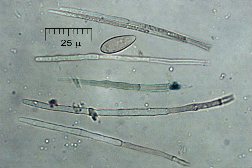 Lachnellula occidentalis (G. G. Hahn & Ayers) Dharne 1965 resmi