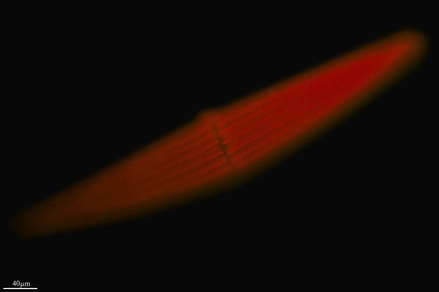 Image of Closterium lunula