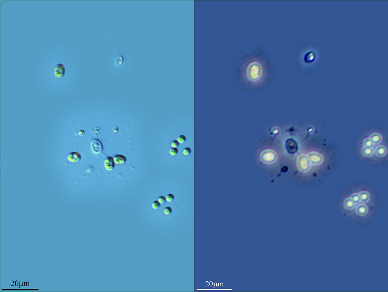 Image of Coenocystis Korshikov 1953