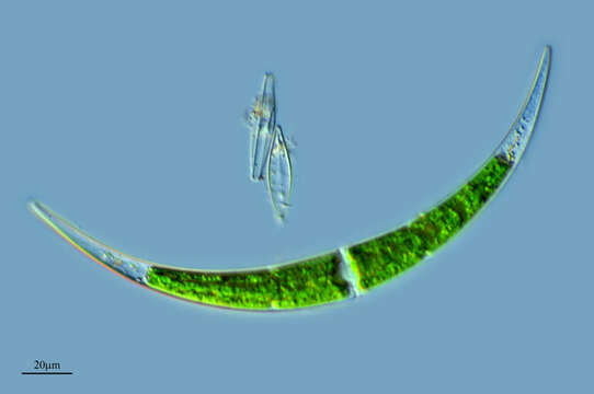 Closterium dianae Ehrenberg ex Ralfs 1848 resmi