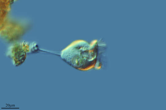 Image of Vorticella campanula