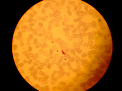 صورة Plasmodium subgen. Laverania