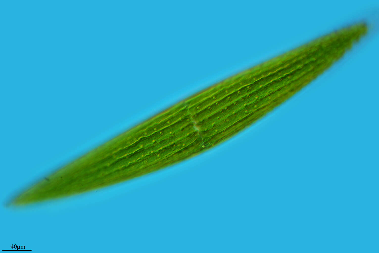 Image of Closterium lunula