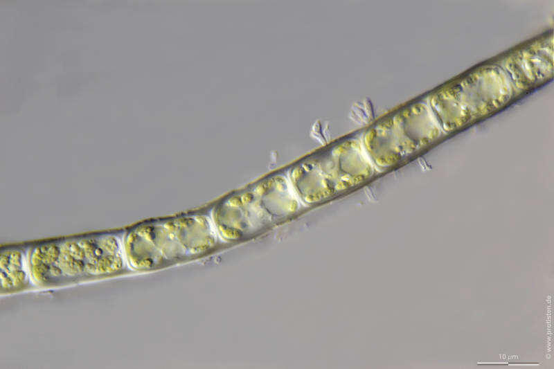 Image of Microspora tumidula Hazen 1902