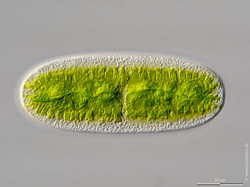 Image of Netrium oblongum