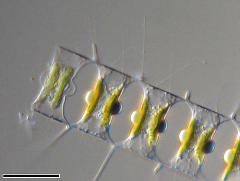 Image of Chaetoceros didymus