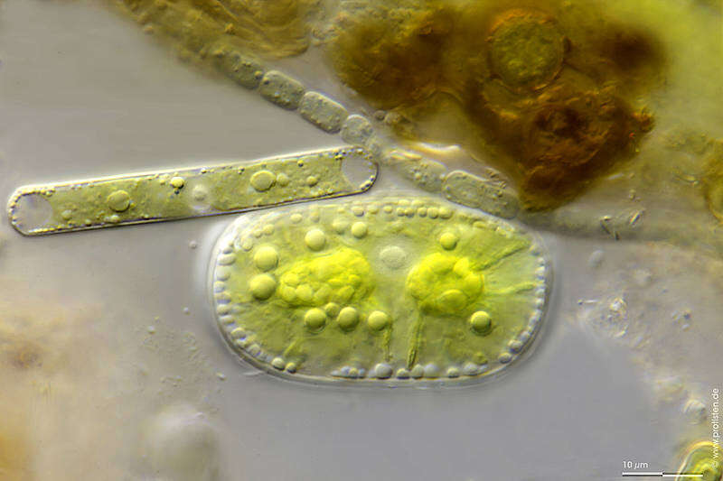 Imagem de Cylindrocystis crassa