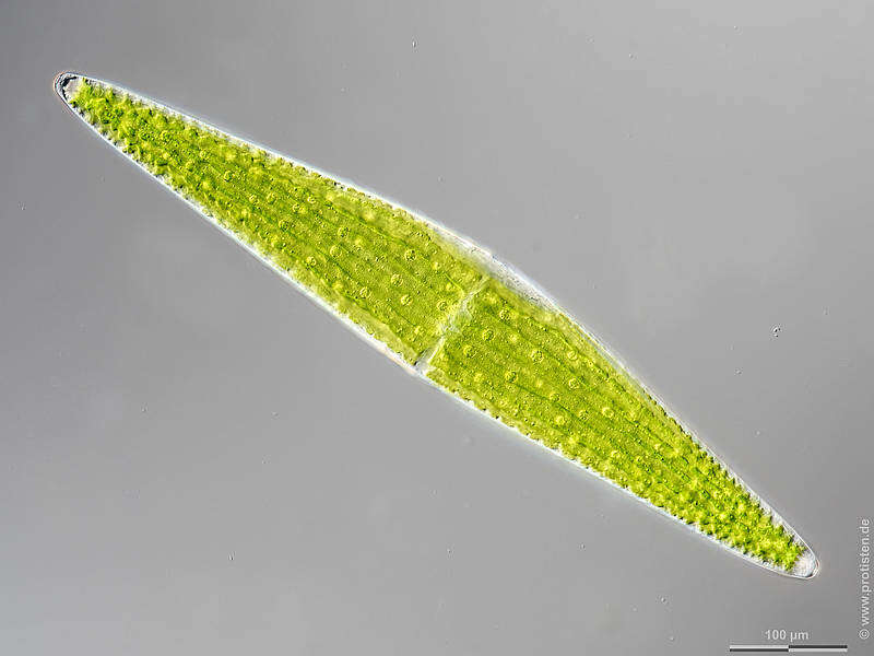 Image of Closterium lunula