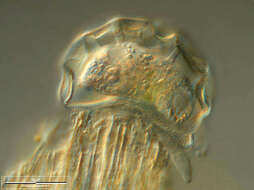 Image of Arcella hemisphaerica