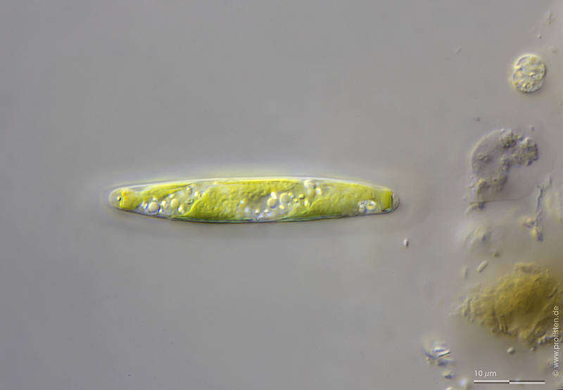 Image of Spirotaenia erythrocephala Itzigsohn 1856