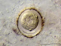 Image of Vorticella similis