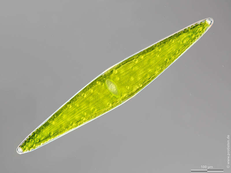 Image of Closterium lunula