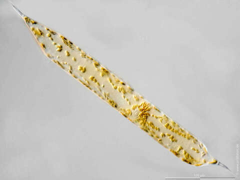 Image of Pseudosolenia calcar-avis