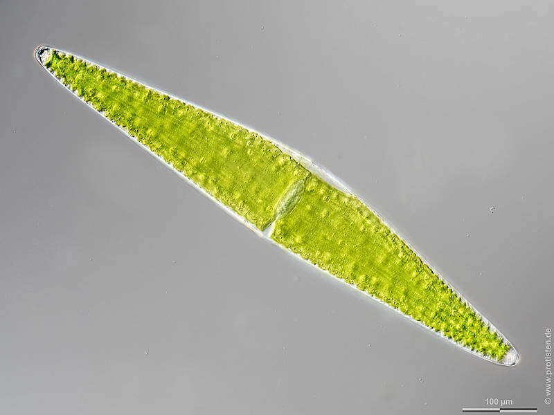 Image of Closterium lunula