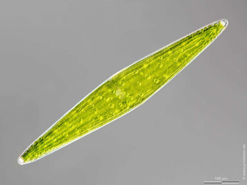 Image of Closterium lunula