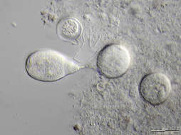 Image of Vorticella similis