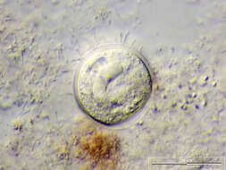 Image of Vorticella similis