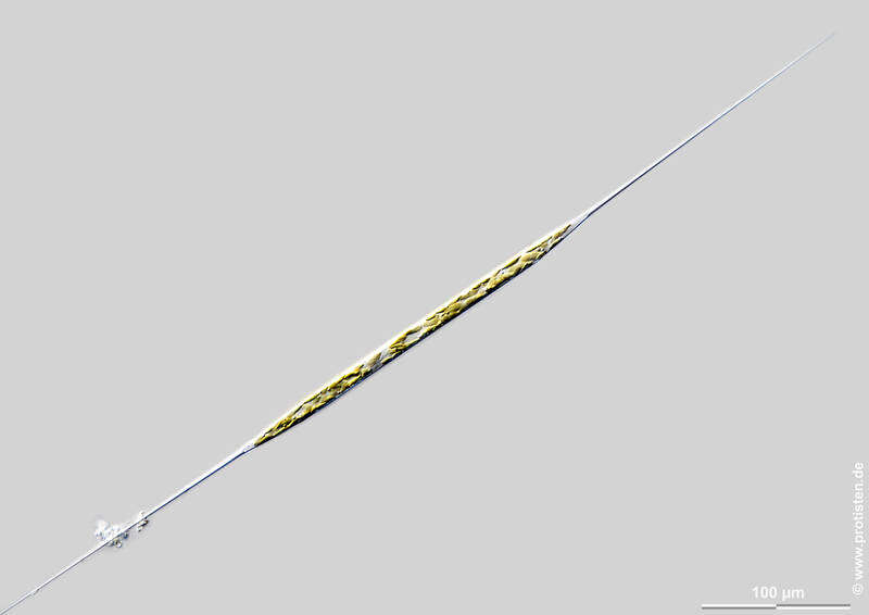 Image of Rhizosolenia setigera