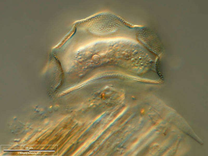 Image of Arcella hemisphaerica