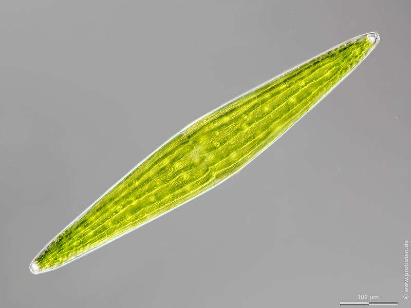 Image of Closterium lunula