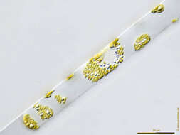 Image of Rhizosolenia setigera