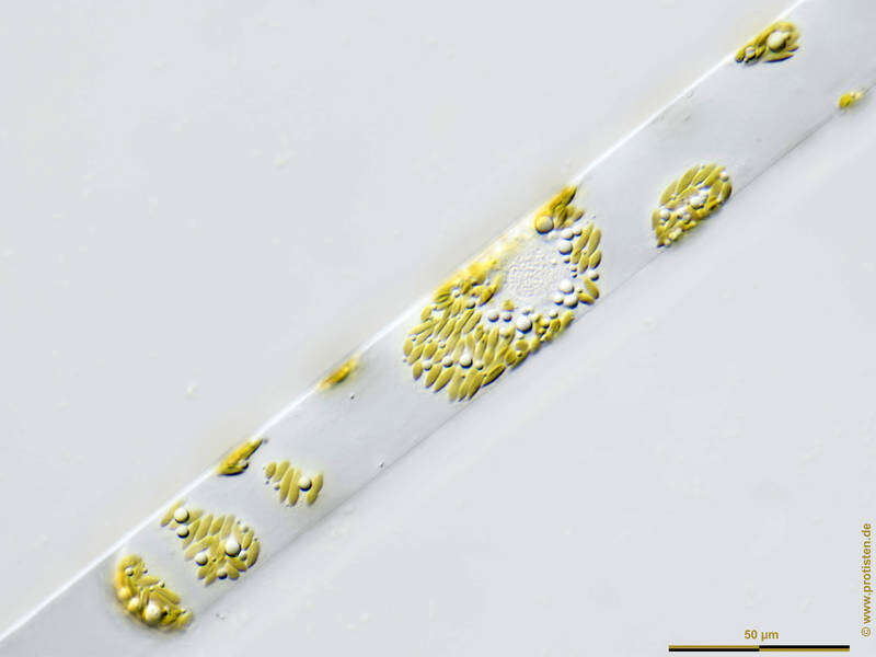 Image of Rhizosolenia setigera