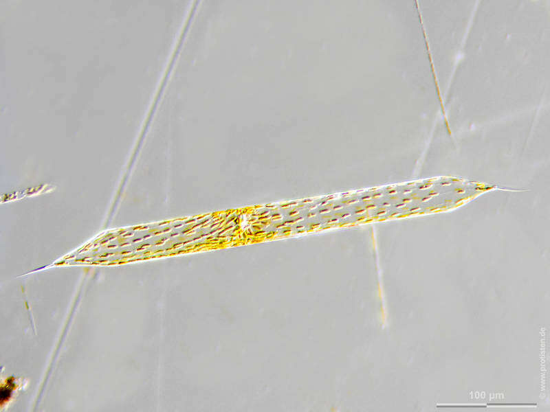 Image of Pseudosolenia calcar-avis