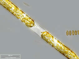 Image of Rhizosolenia setigera