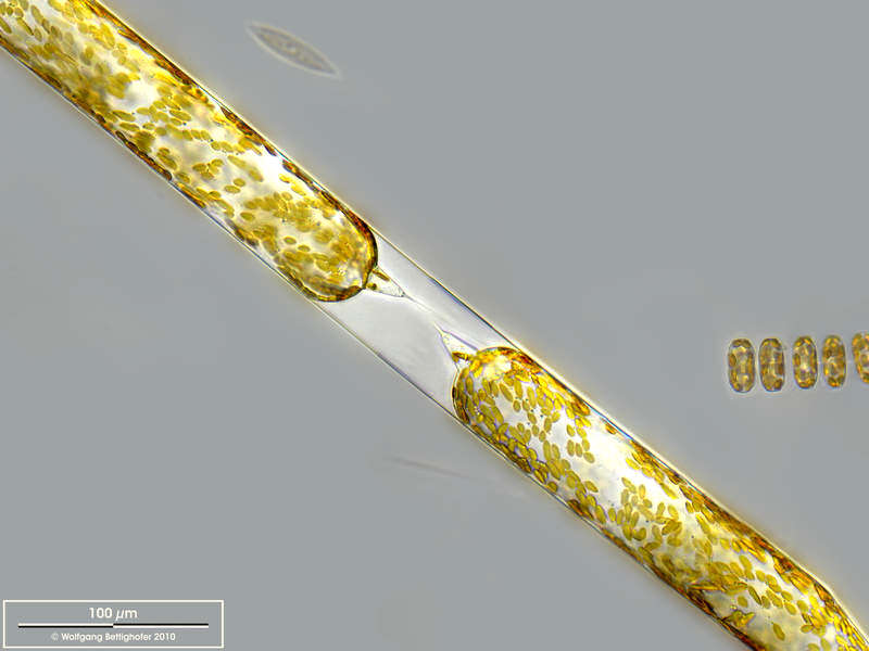 Image of Rhizosolenia setigera