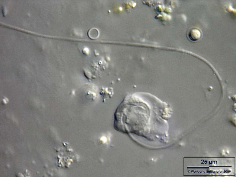 Image of Platyamoeba