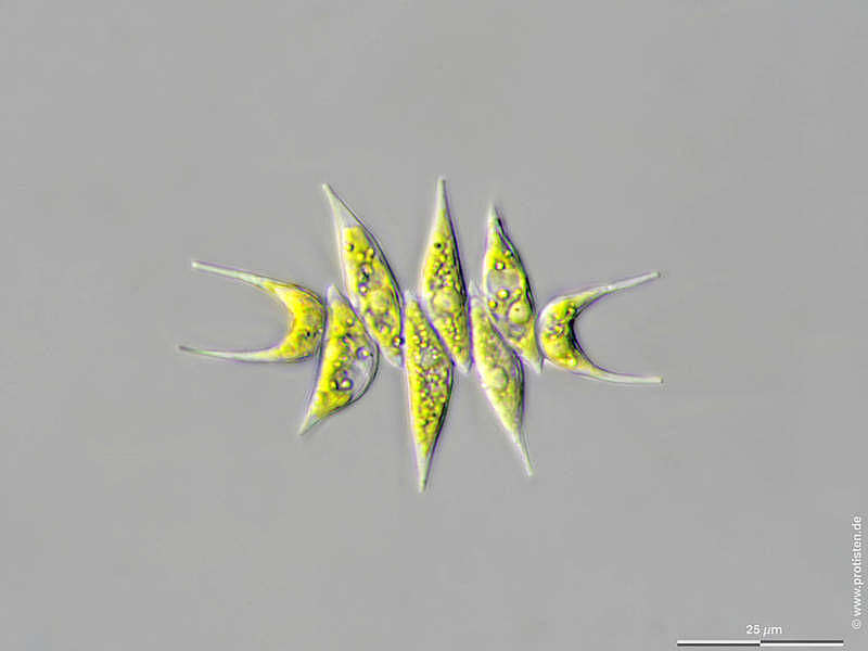 Image of Tetradesmus lagerheimii M. J. Wynne & Guiry 2016