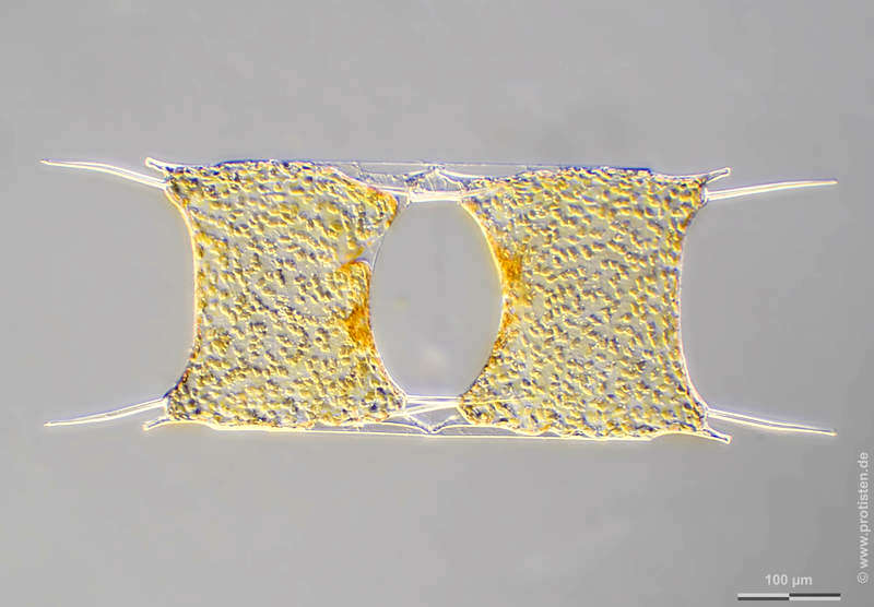 Image of Diatom