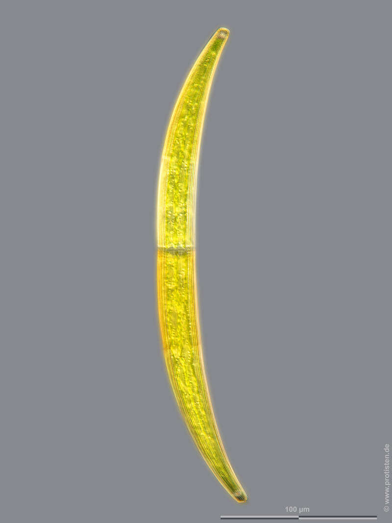 Image of Closterium intermedium Ralfs 1848