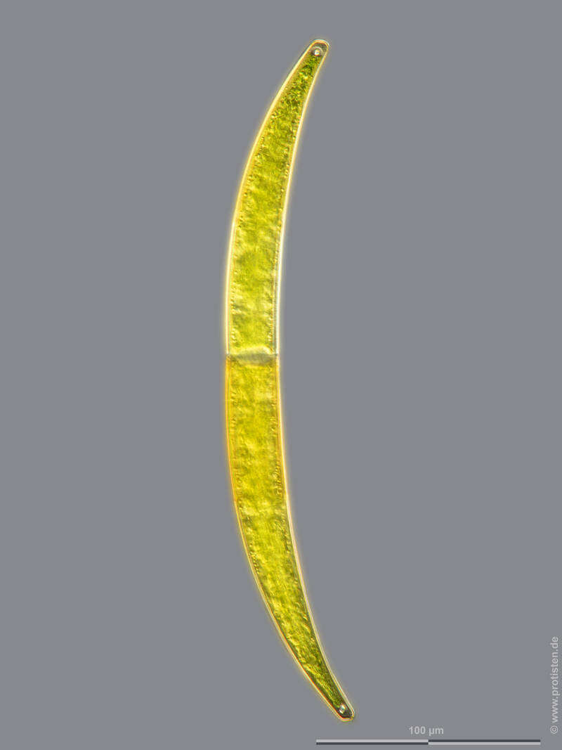 Image of Closterium intermedium Ralfs 1848