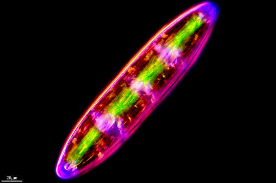 Image of Planotaenium (Ohtani) Petlovany & Palamar-Mordvintseva 2009