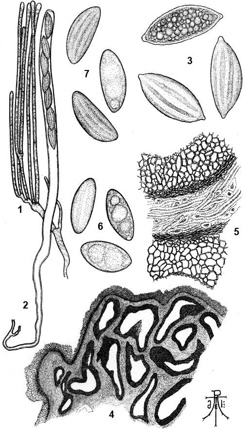 Image of Wynnea americana Thaxt. 1905