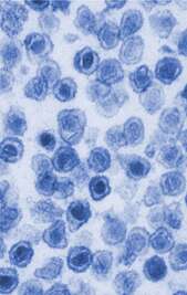 Image of Gammaretrovirus