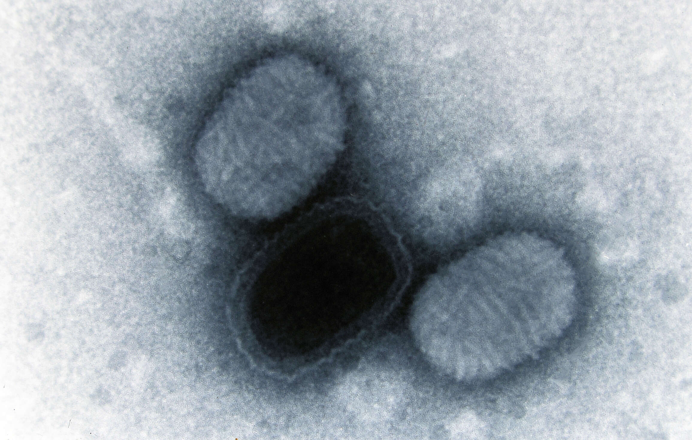 Image of Molluscum contagiosum virus