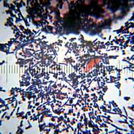 Image of Staphylococcus saprophyticus
