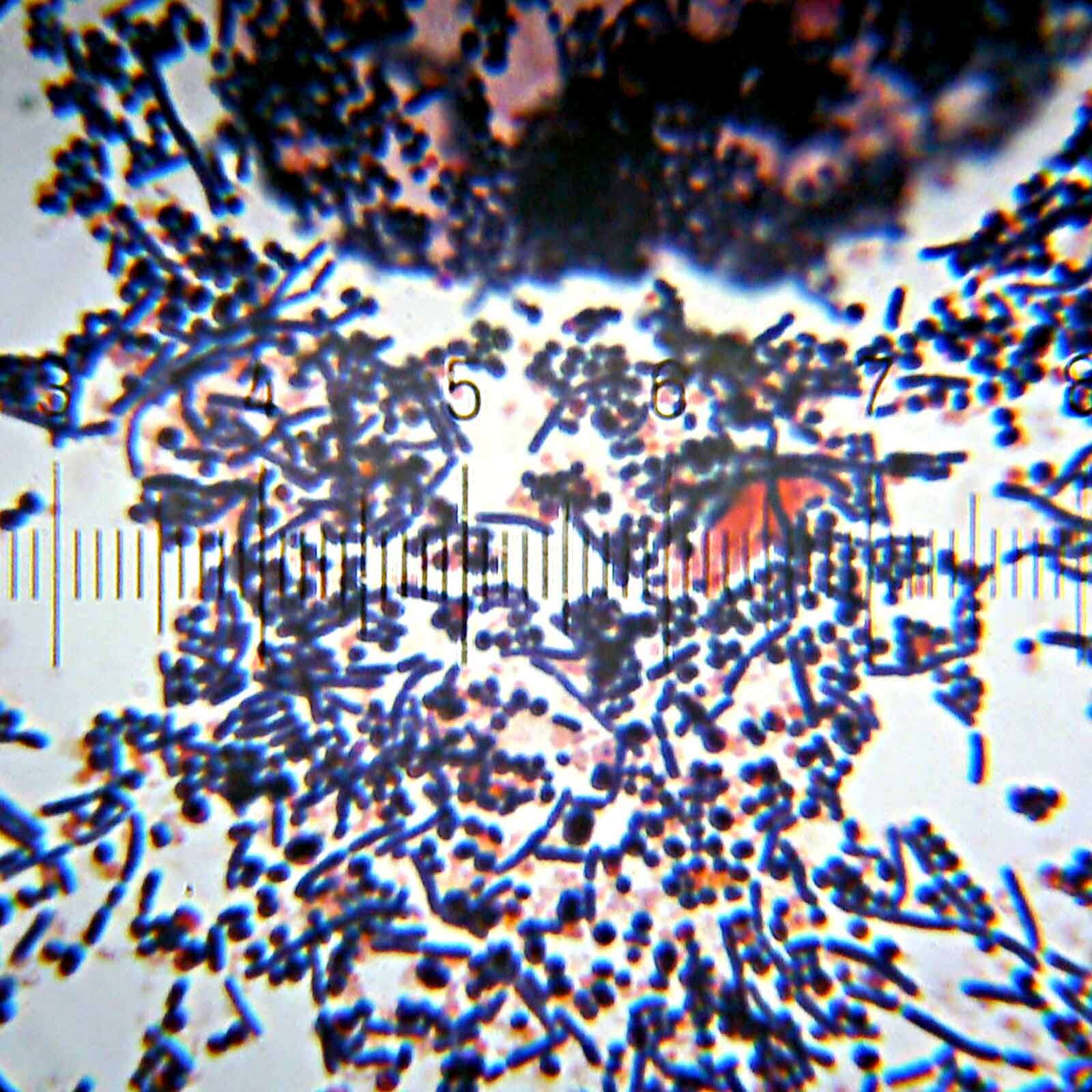 Plancia ëd Staphylococcus saprophyticus