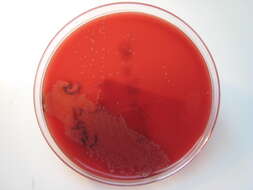 Image of Streptococcus dysgalactiae