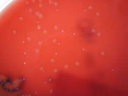 Image of Streptococcus dysgalactiae