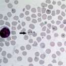 Image of Babesia bovis