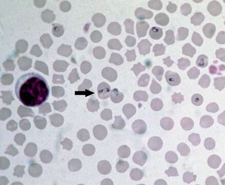 Image of Babesia bovis