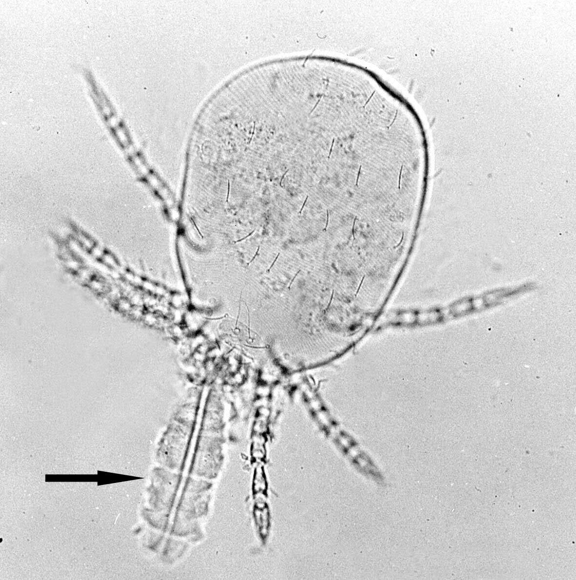 Plancia ëd Trombicula