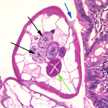 Image of Human pinworms