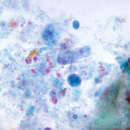 Image de Dientamoeba fragilis